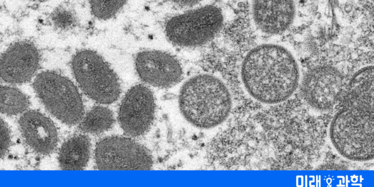 여행 풀렸는데 ‘원숭이두창’ 세계 확산…팬데믹 될 가능성은?