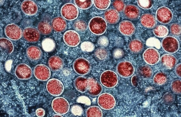 엠폭스 3명 또 늘었다…“모르는 사람과 밀접접촉 주의”