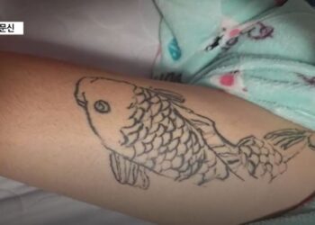“연습 좀 하자” 중학생 허벅지에 ‘20㎝ 잉어 문신’ 새겨