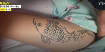 “연습 좀 하자” 중학생 허벅지에 ‘20㎝ 잉어 문신’ 새겨
