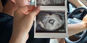 장동민, 결혼 2년 만에 기쁜 소식… 두 아이 아빠 돼