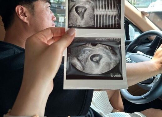 장동민, 결혼 2년 만에 기쁜 소식… 두 아이 아빠 돼