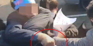 흉기 피습 이재명, 2시간 혈관재건술 후 중환자실서 회복중