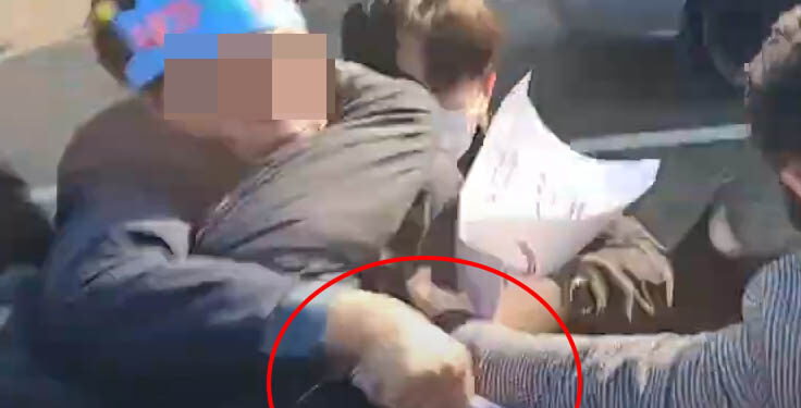 흉기 피습 이재명, 2시간 혈관재건술 후 중환자실서 회복중