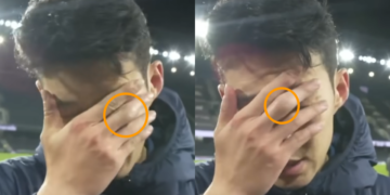 “고통스럽다”며 얼굴 감싼 손흥민…손가락 상태 그대로 드러났다