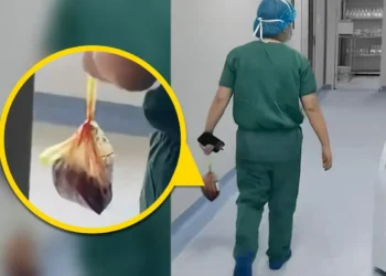 “의사가 산모 태반 몰래 반출”…中 여전히 ‘사람 태반’ 복용·거래 의혹