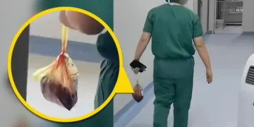 “의사가 산모 태반 몰래 반출”…中 여전히 ‘사람 태반’ 복용·거래 의혹