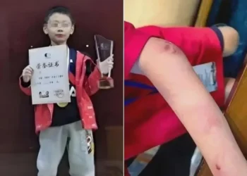 몸 곳곳 ‘멍 자국’… 투신 사망한 中 9살 ‘바둑 신동’ 어쩌다