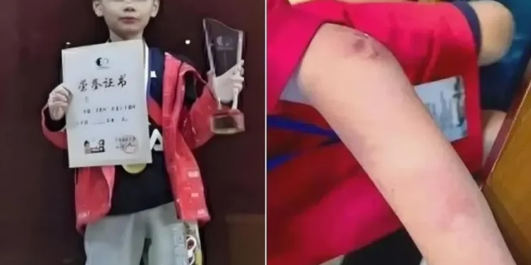 몸 곳곳 ‘멍 자국’… 투신 사망한 中 9살 ‘바둑 신동’ 어쩌다