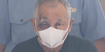 “그만 맞고 싶다” 장남 살인미수 日아버지, 얼굴엔 ‘멍자국’이… [포착]