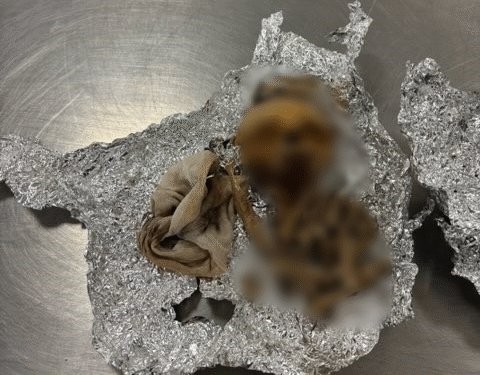 美공항 세관에서 적발된 두개골…승객에게 이유 물어보니 ‘경악’