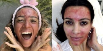 “그 피 맞아요” SNS서 번지는 ‘월경 마스크팩’ 논란…킴 카다시안처럼?