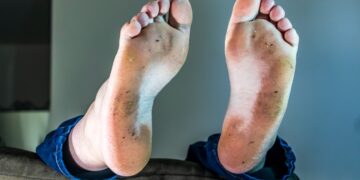 ‘이것’ 안 빨고 이틀째 또? 발냄새 끝판왕된다…900만 마리 세균 ‘득실’