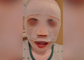 [속보] “다른 남자 만날까 봐” 태국인 아내 얼굴에 ‘끓는 물’ 부은 한국인 남성 검거